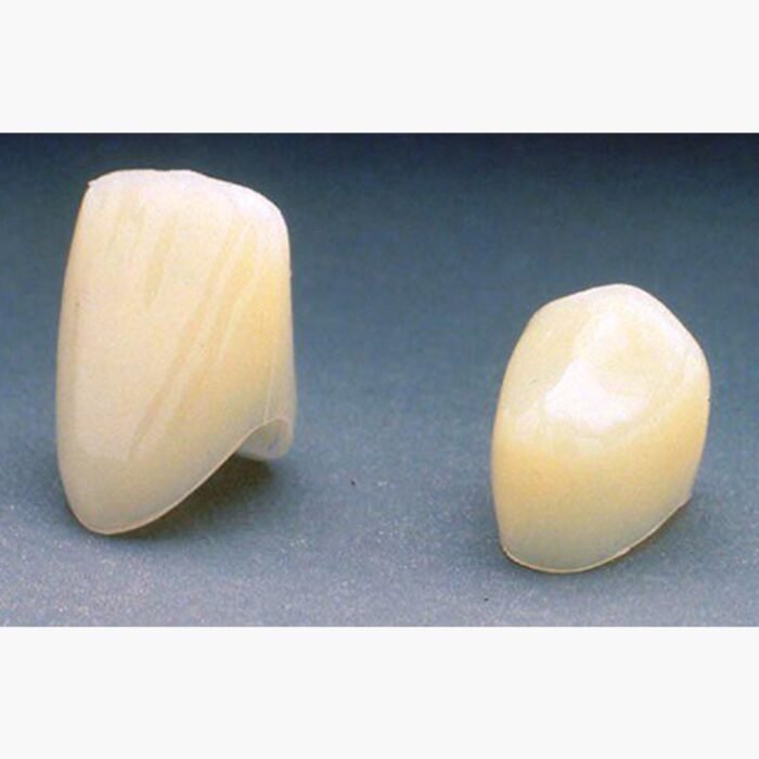 3M ESPE Polycarbonate Crowns Intro Kit C180 - Image 3