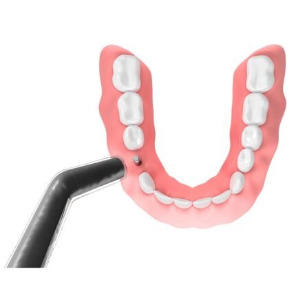 W&H SmartPegs - Image 3