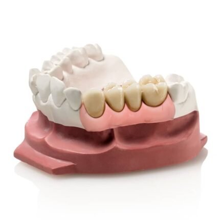 Gingifast Elastic denture