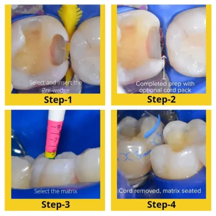 BioClear-Evolve-Matrices-Treatment-Steps-1