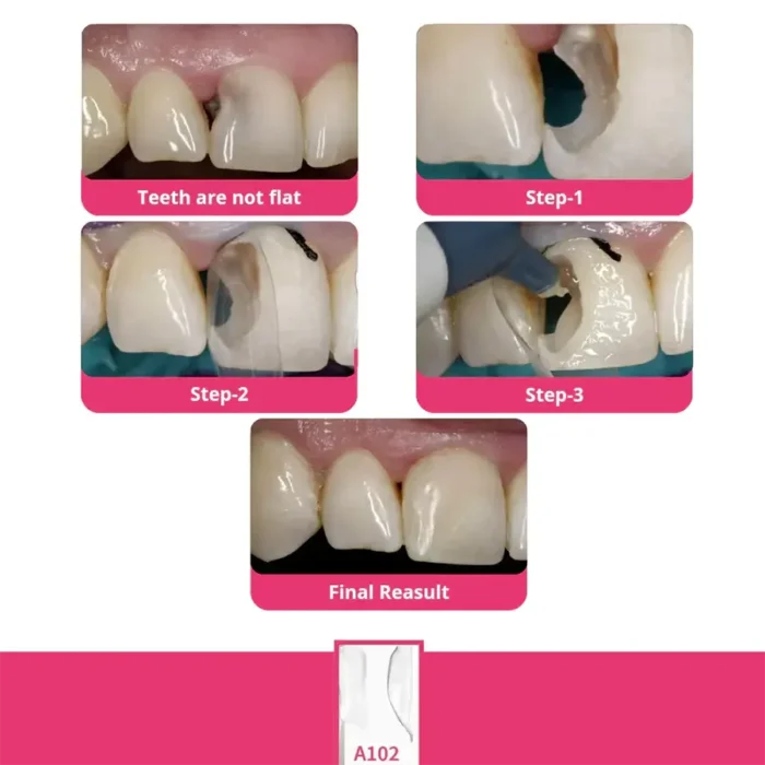 anterior_matrix-7