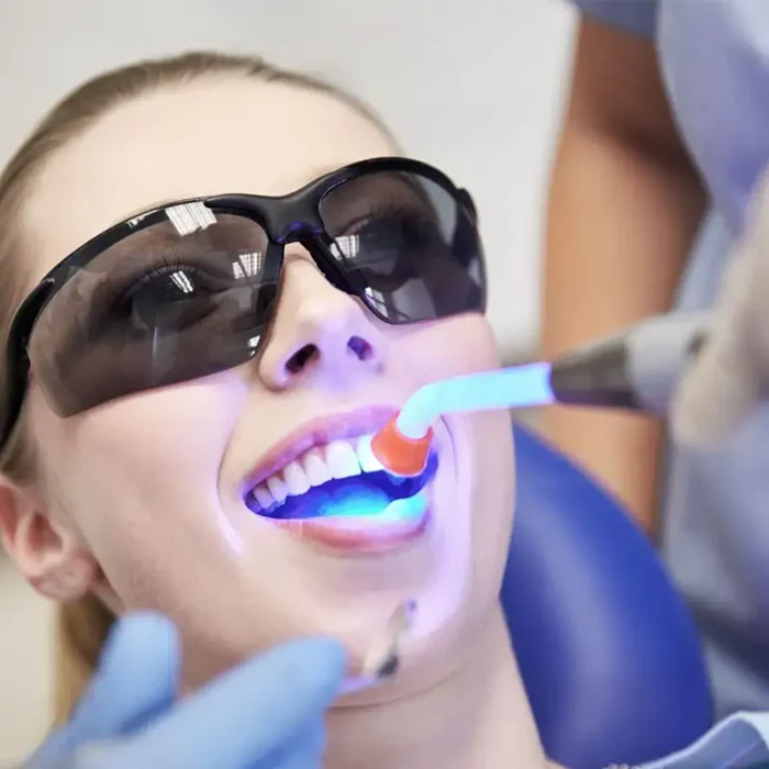 Coltene Coltolux Led Light Cure using in mouth