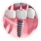 Implantology