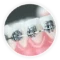 Orthodontics-Cat