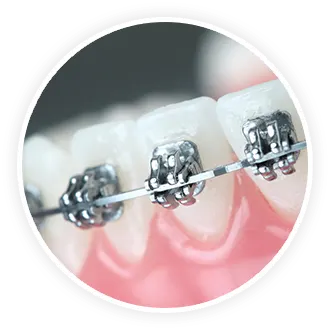 Orthodontics-Cat