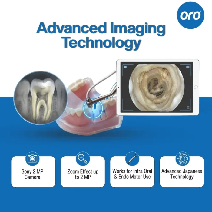 Oro Endo Micro Camera - Image 4